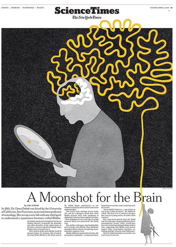 A Moonshot for the Brain